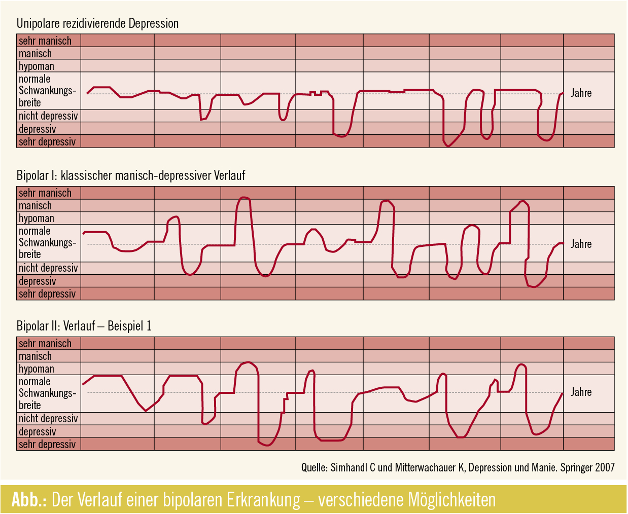 Diagnose Bipolar | Spectrum Psychiatrie | MedMedia